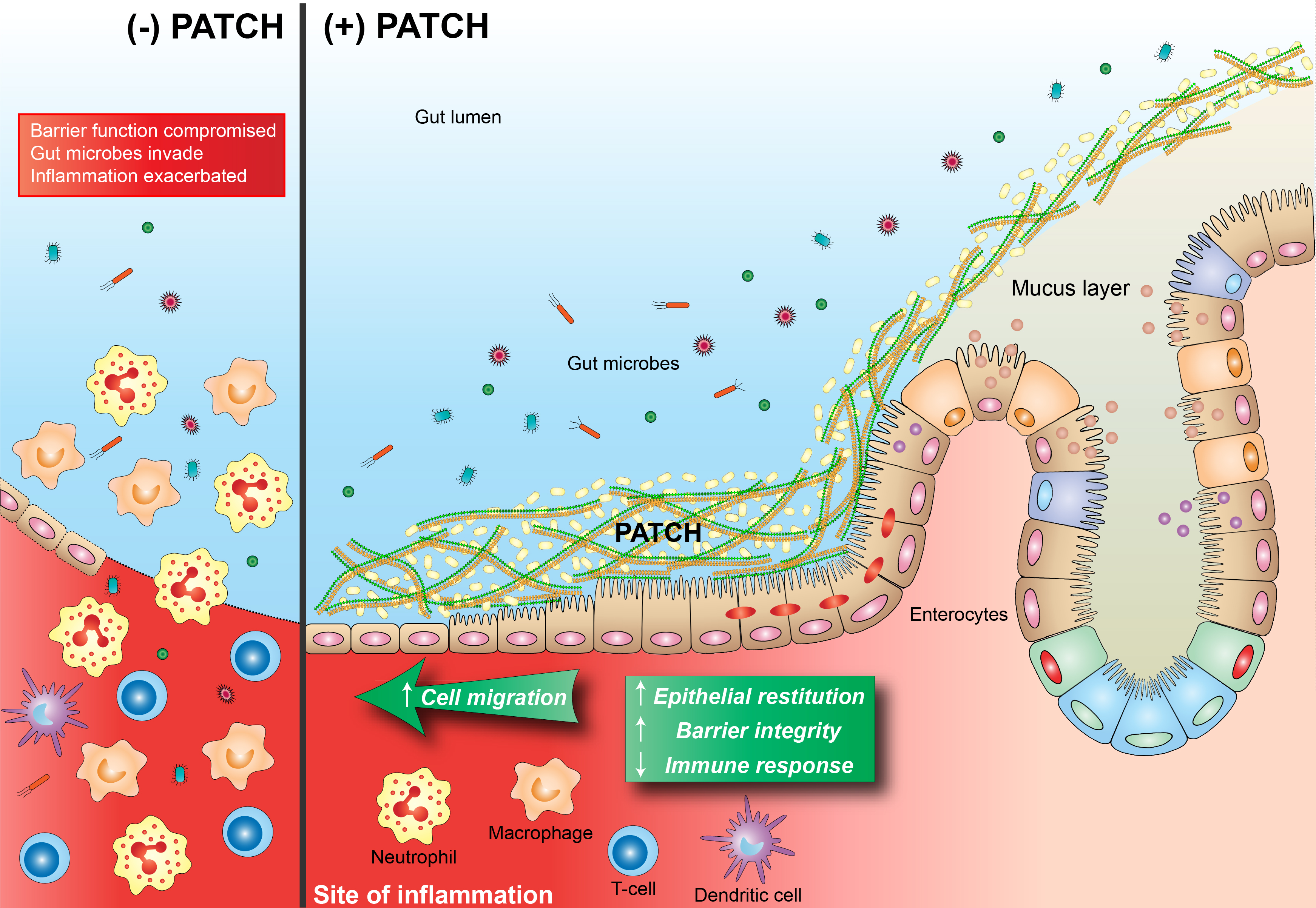 Empowering Mucosal Healing With An Engineered Probiotic