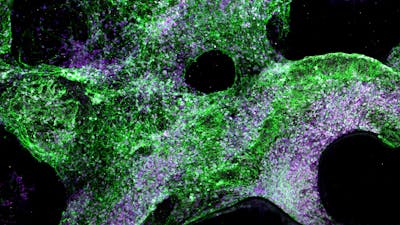 ImageJ=1.53c
unit=micron