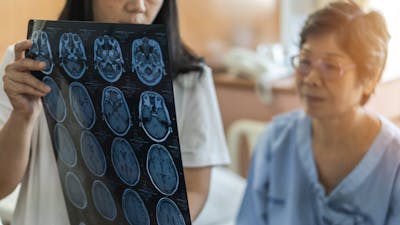 Brain disease diagnosis with medical doctor diagnosing elderly ageing patient neurodegenerative illness problem seeing Magnetic Resonance Imaging (MRI) film for neurological medical treatment