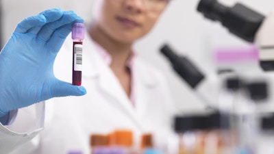 Scientist preparing clinical samples for medical testing in a laboratory